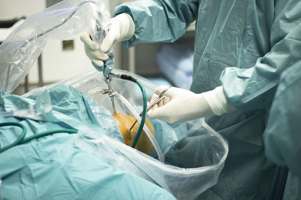 χειρουργική αντιμετώπιση της οστεοαρθρίτιδας